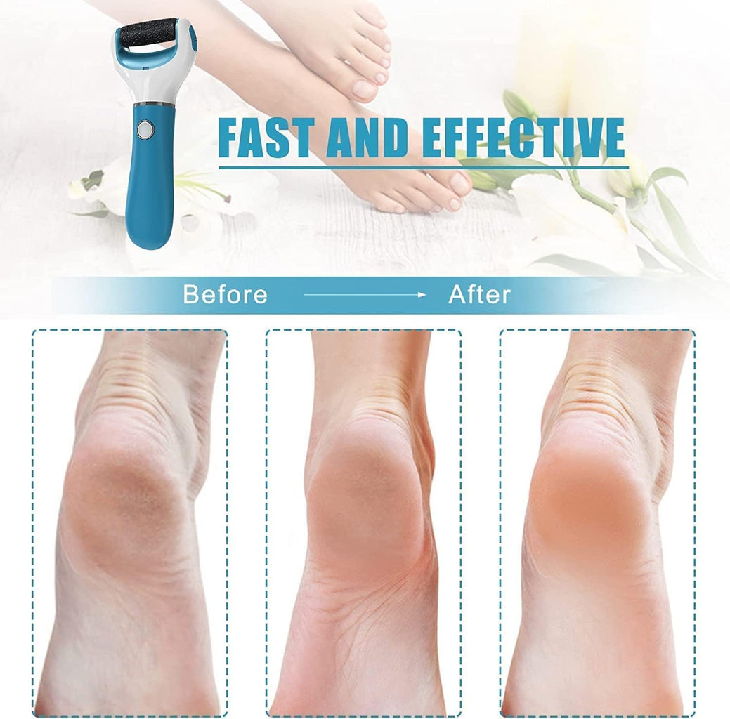 Llima Elèctrica Blava - Set de Manicura i Pedicura per Eliminar Dureses i Cura de Peus