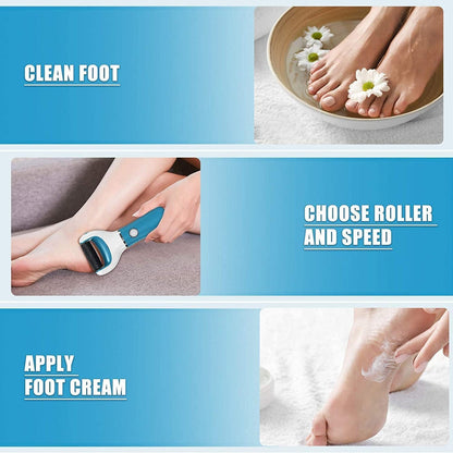 Llima Elèctrica Blava - Set de Manicura i Pedicura per Eliminar Dureses i Cura de Peus